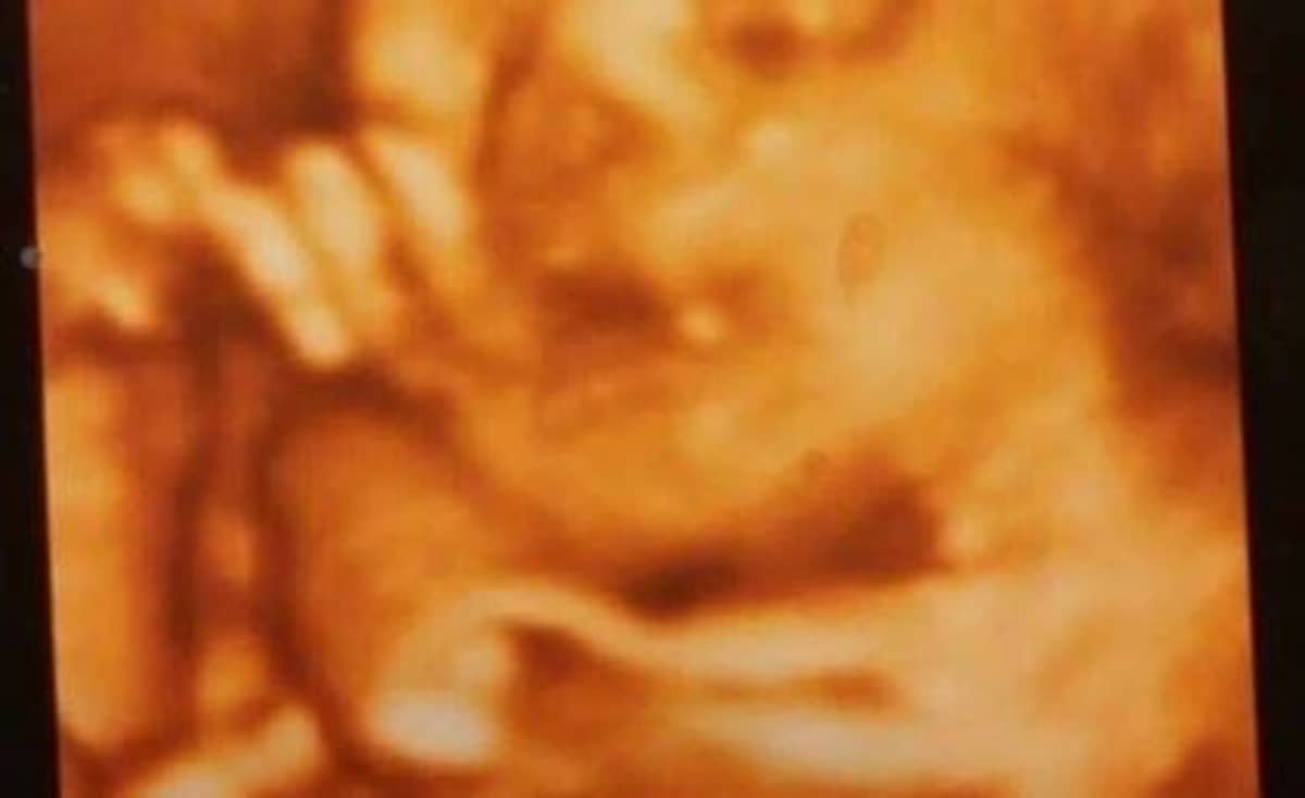 Proud Mum's Ultrasound Of Her Unborn Baby Is Mistaken For A 'Crisp Lasagne'  - LADbible