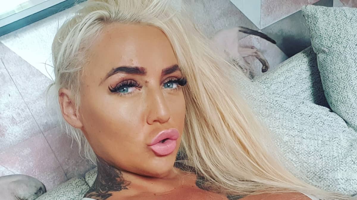 Botox Lips - Porn Star Rushed To Hospital After Lip Filler Operation Goes Wrong -  LADbible