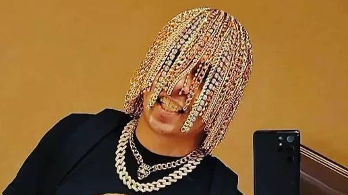 Dan Sur Has Gold Chains Surgically Implanted Into Head As 'Hair'