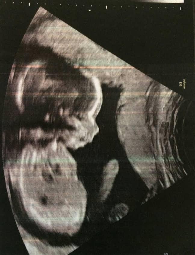 The Baby In This Ultrasound Probably Has A Bigger Wang Than You - LADbible