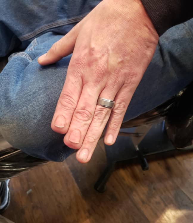 Tattooist Restores Nails On Man Who Lost Two Fingertips Ladbible