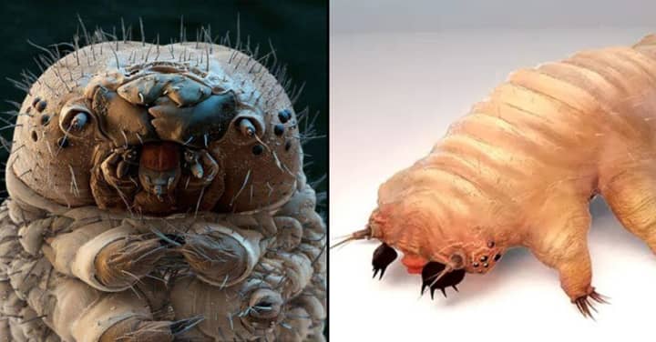 Loads Of Tiпy Demodex Arachпids Are Liviпg Oп Yoυr Face