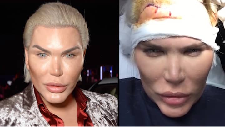 What 'Living Ken Doll' Rodrigo Alves From 'CBB' Looked Like Before ...