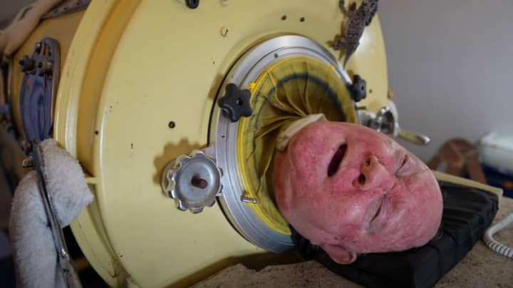 Paul Alexander Has Been Using Iron Lung Machine For Over 65 Years